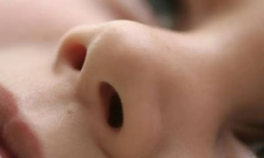 LA RINOPLASTICA MODERNA